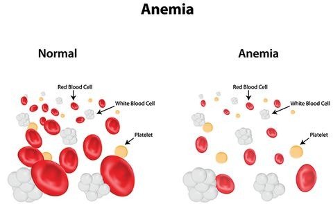 Anemia or lack of blood cancer symptom