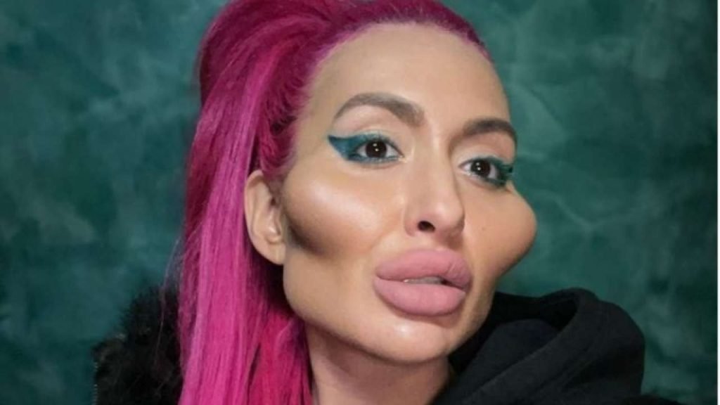 Anstasia Pokreshchuk cheek surgery