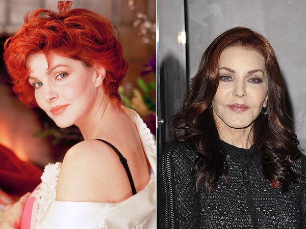 Cosmetic Surgeries of Actresses