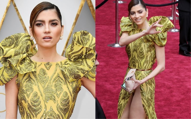 Oscars wardrobe malfunctions