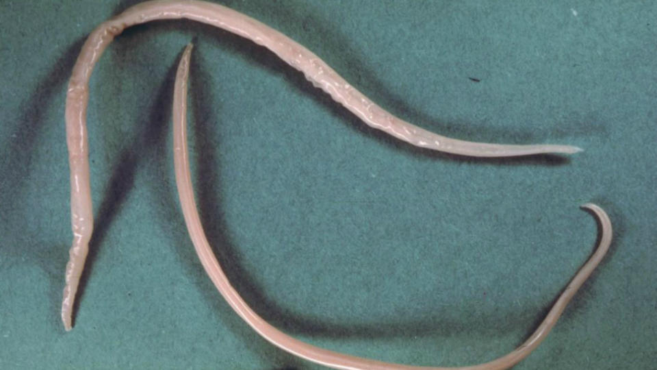 Ascaris Lumbricoides