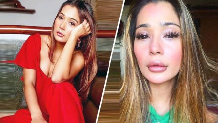 sara khan lip surgery