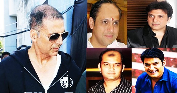 5 Actors Who Have Become Bald In Real Life