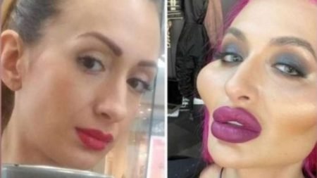 This Girl With “World’s Biggest Cheeks” Is Shocking Everyone: Deets Inside Anstasia Pokreshchuk